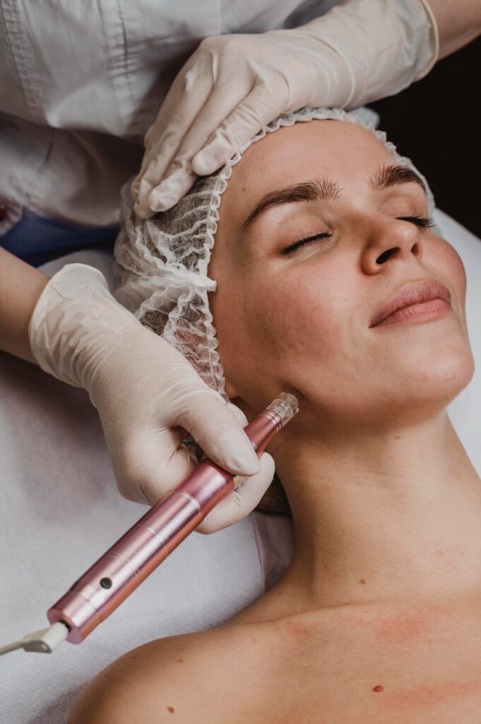 Unlock Your Skin’s Potential: Microneedling at Med Spa Merced